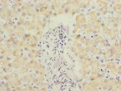 Invitrogen ECHS1 Polyclonal Antibody 100 &mu;L; Unconjugated:Antibodies,