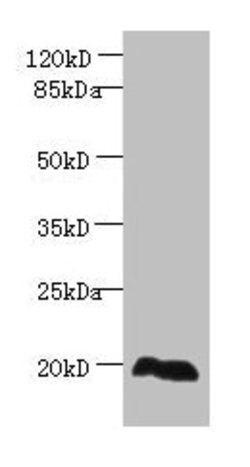 Invitrogen EEF1E1 Polyclonal Antibody 100 &mu;g; Unconjugated:Antibodies,