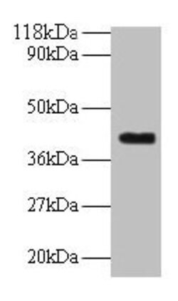 Invitrogen ELAVL2 Polyclonal Antibody 100 &mu;g; Unconjugated:Antibodies,