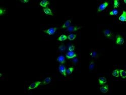 Invitrogen CD39 Polyclonal Antibody 100 &mu;g; Unconjugated:Antibodies,