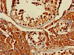Invitrogen ERLIN1 Polyclonal Antibody 100 &mu;g; Unconjugated:Antibodies,