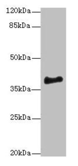 Invitrogen ERLIN1 Polyclonal Antibody 100 &mu;g; Unconjugated:Antibodies,