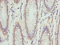 Invitrogen ERLIN2 Polyclonal Antibody 100 &mu;L; Unconjugated:Antibodies,