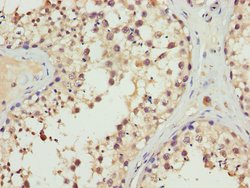 Invitrogen ERLIN2 Polyclonal Antibody 100 &mu;L; Unconjugated:Antibodies,