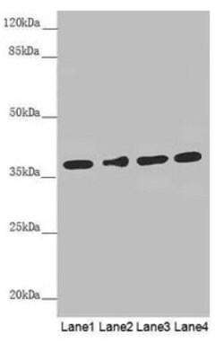 Invitrogen ERLIN2 Polyclonal Antibody 100 &mu;L; Unconjugated:Antibodies,