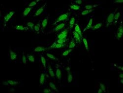 Invitrogen ESRP2 Polyclonal Antibody 100 &mu;g; Unconjugated:Antibodies,