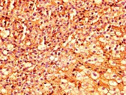 Invitrogen ESRP2 Polyclonal Antibody 100 &mu;g; Unconjugated:Antibodies,