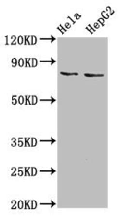 Invitrogen ESRP2 Polyclonal Antibody 100 &mu;g; Unconjugated:Antibodies,