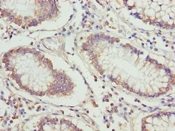 Invitrogen ETFA Polyclonal Antibody 100 &mu;L; Unconjugated:Antibodies,