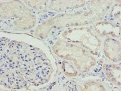 Invitrogen ETFA Polyclonal Antibody 100 &mu;L; Unconjugated:Antibodies,