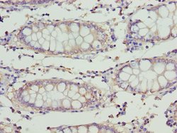 Invitrogen ETFA Polyclonal Antibody 100 &mu;L; Unconjugated:Antibodies,