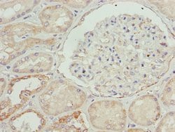 Invitrogen ETFA Polyclonal Antibody 100 &mu;L; Unconjugated:Antibodies,