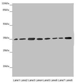 Invitrogen ETFA Polyclonal Antibody 100 &mu;L; Unconjugated:Antibodies,