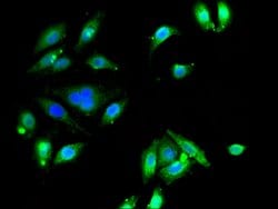 ETNK1 Polyclonal Antibody:Antibodies, Polyclonal