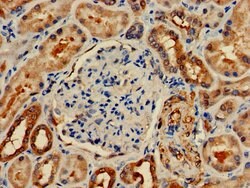 ETNK1 Polyclonal Antibody:Antibodies, Polyclonal