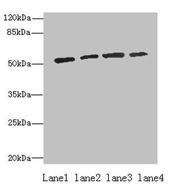 ETNK1 Polyclonal Antibody:Antibodies, Polyclonal