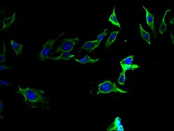 Invitrogen Prothrombin Polyclonal Antibody 100 &mu;g; Unconjugated:Antibodies,