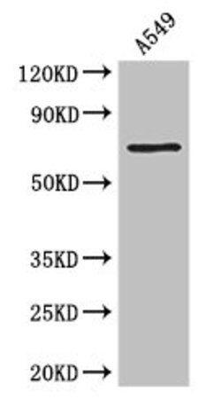 Invitrogen Prothrombin Polyclonal Antibody 100 &mu;g; Unconjugated:Antibodies,