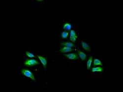 Invitrogen FADS1 Polyclonal Antibody 100 &mu;g; Unconjugated:Antibodies,