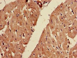 Invitrogen FADS1 Polyclonal Antibody 100 &mu;g; Unconjugated:Antibodies,