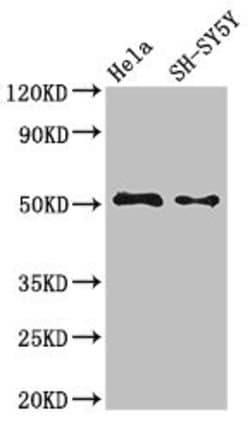 Invitrogen FADS1 Polyclonal Antibody 100 &mu;g; Unconjugated:Antibodies,