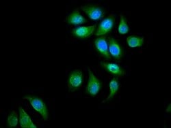 Invitrogen eIF3d Polyclonal Antibody 100 &mu;g; Unconjugated:Antibodies,