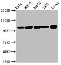 Invitrogen eIF3d Polyclonal Antibody 100 &mu;g; Unconjugated:Antibodies,