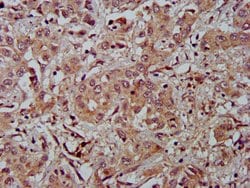 Invitrogen Fibulin 2 Polyclonal Antibody 100 &mu;g; Unconjugated:Antibodies,