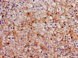 Invitrogen FDFT1 Polyclonal Antibody 100 &mu;g; Unconjugated:Antibodies,