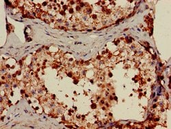 Invitrogen FDXR Polyclonal Antibody 100 &mu;g; Unconjugated:Antibodies,