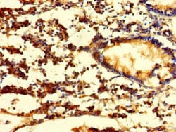 FGF13 Polyclonal Antibody:Antibodies, Polyclonal