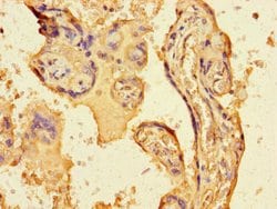 FGF13 Polyclonal Antibody:Antibodies, Polyclonal