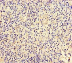 FGF13 Polyclonal Antibody:Antibodies, Polyclonal