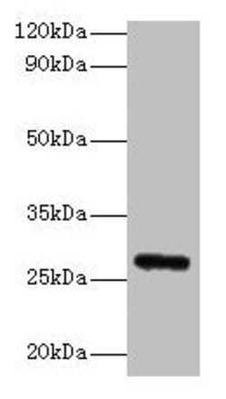 Invitrogen FGF23 Polyclonal Antibody 100 &mu;g; Unconjugated:Antibodies,