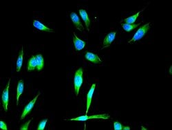 Invitrogen FGFR1 Polyclonal Antibody 100 &mu;g; Unconjugated:Antibodies,