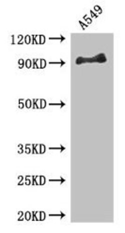 Invitrogen FGFR1 Polyclonal Antibody 100 &mu;g; Unconjugated:Antibodies,