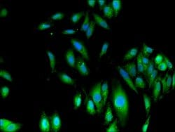 Invitrogen Fumarase Polyclonal Antibody 100 &mu;g; Unconjugated:Antibodies,