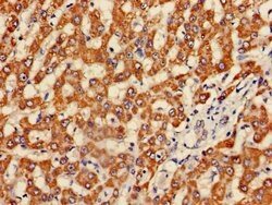 Invitrogen Fumarase Polyclonal Antibody 100 &mu;g; Unconjugated:Antibodies,