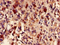 Invitrogen Fumarase Polyclonal Antibody 100 &mu;g; Unconjugated:Antibodies,