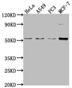 Invitrogen FKTN Polyclonal Antibody 100 &mu;L; Unconjugated:Antibodies,