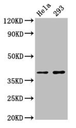 Invitrogen FOXH1 Polyclonal Antibody 100 &mu;g; Unconjugated:Antibodies,