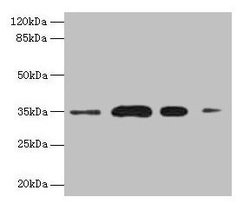 Invitrogen SULT1A3 Polyclonal Antibody 100 &mu;g; Unconjugated:Antikörper