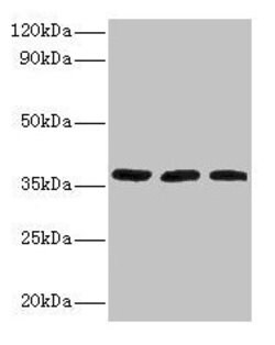 Invitrogen FTSJ1 Polyclonal Antibody 100 &mu;g | Buy Online | Invitrogen&trade; | Fisher Scientific