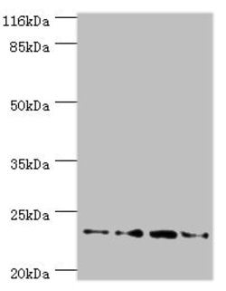 FXN Polyclonal Antibody:Antibodies, Polyclonal