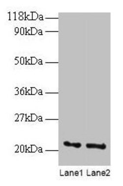 Invitrogen ARF4 Polyclonal Antibody 100 &mu;g | Buy Online | Invitrogen&trade; | Fisher Scientific