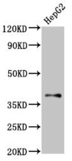 Invitrogen GALR1 Polyclonal Antibody 100 &mu;g | Buy Online | Invitrogen&trade; | Fisher Scientific