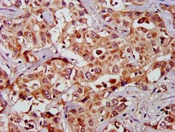Invitrogen GAS2 Polyclonal Antibody 100 &mu;g; Unconjugated:Antibodies,