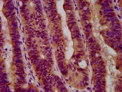 Invitrogen GBA Polyclonal Antibody 100 &mu;g; Unconjugated:Antikörper