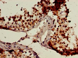 Invitrogen GCM2 Polyclonal Antibody 100 &mu;g; Unconjugated:Antibodies,