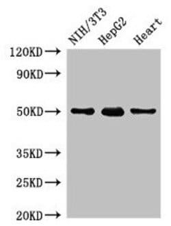Invitrogen GCM2 Polyclonal Antibody 100 &mu;g; Unconjugated:Antibodies,